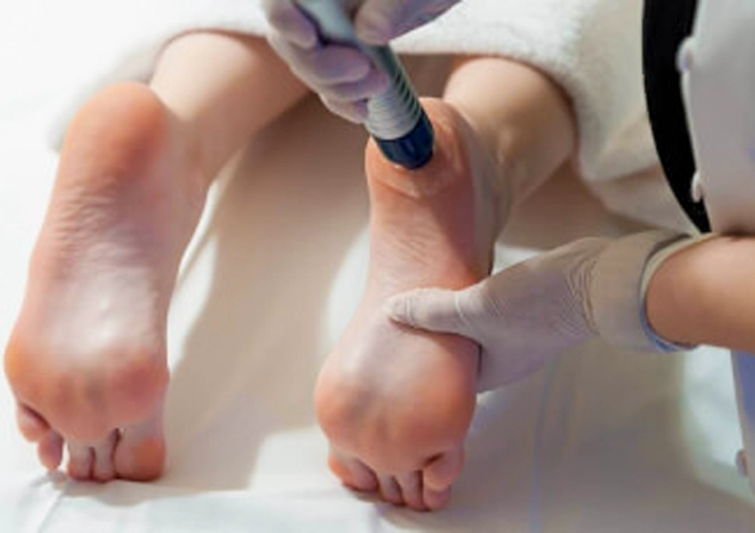 Topuk Dikeni Tedavisi