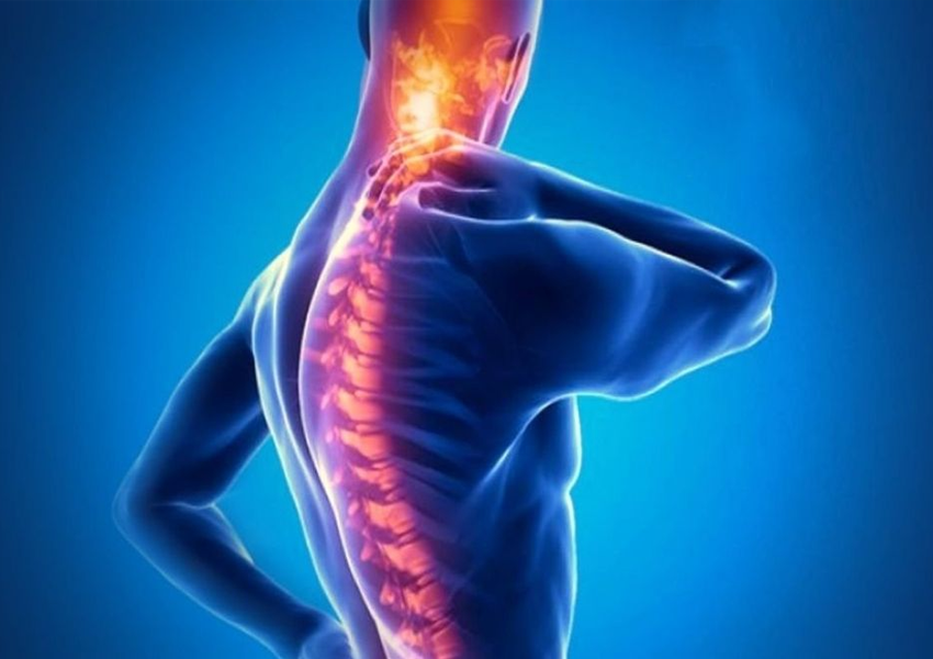 Ankilozan Spondilit Tedavisi