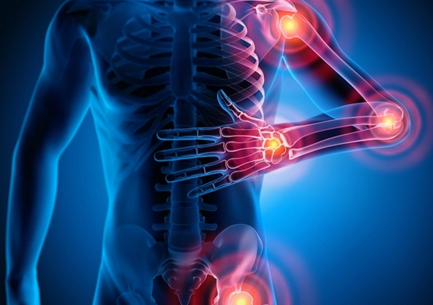 Kas Romatizması Tedavisi